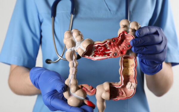 பெருங்குடல் புற்றுநோய் அபாயம்