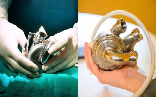 கண்டுபிடிக்கப்பட்டது செயற்கை இதயம்: வைத்தியர்கள் சாதனை